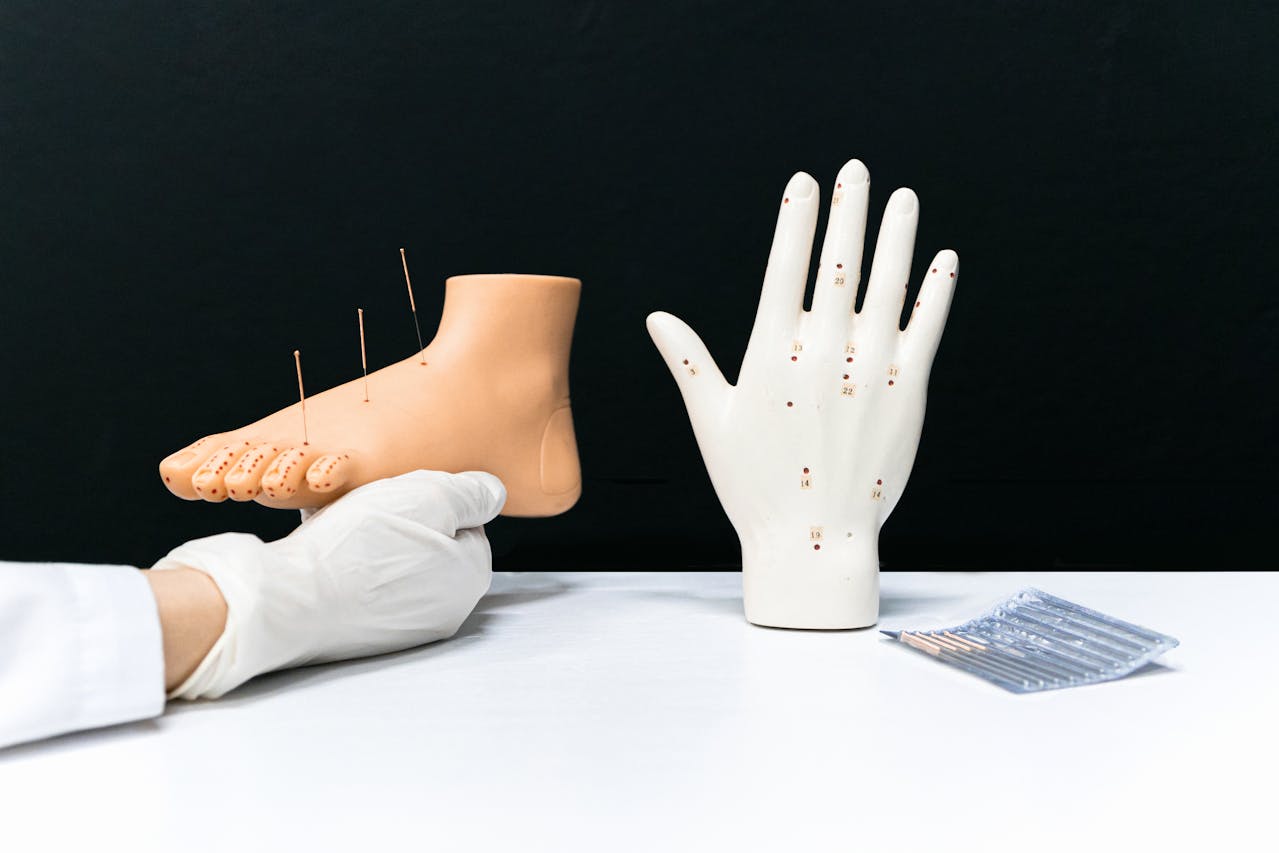 Acupuncture: Myths and Benefits