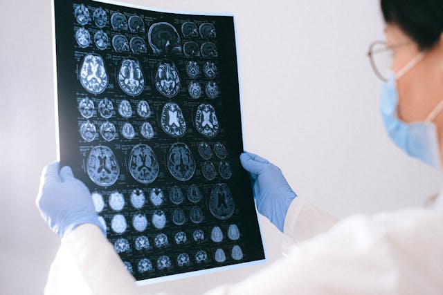 Brain Structure: The Basics